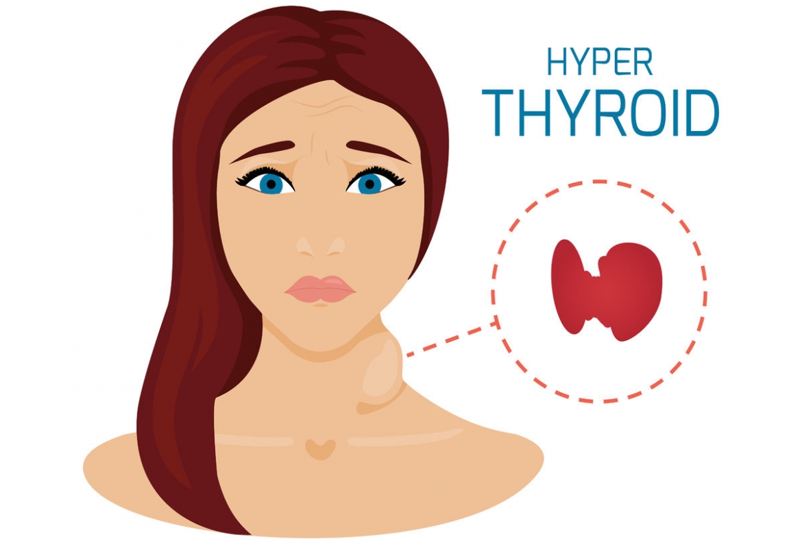 Thyroid Storm Full Overview